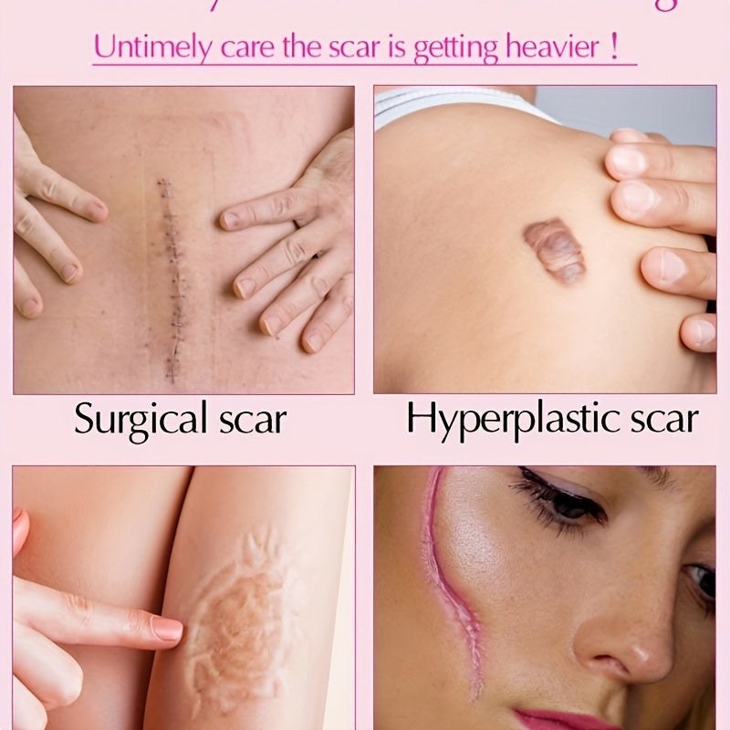 Advanced Formula for Fading Scars, Acne Scars, and Surgery Scars