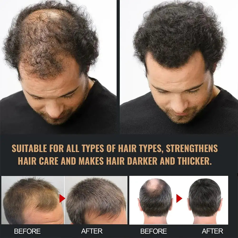 Thickening Root Activator Shampoo