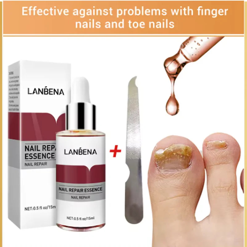 LANBENA Fungus Care Remove Onychomycosis, nail fungus