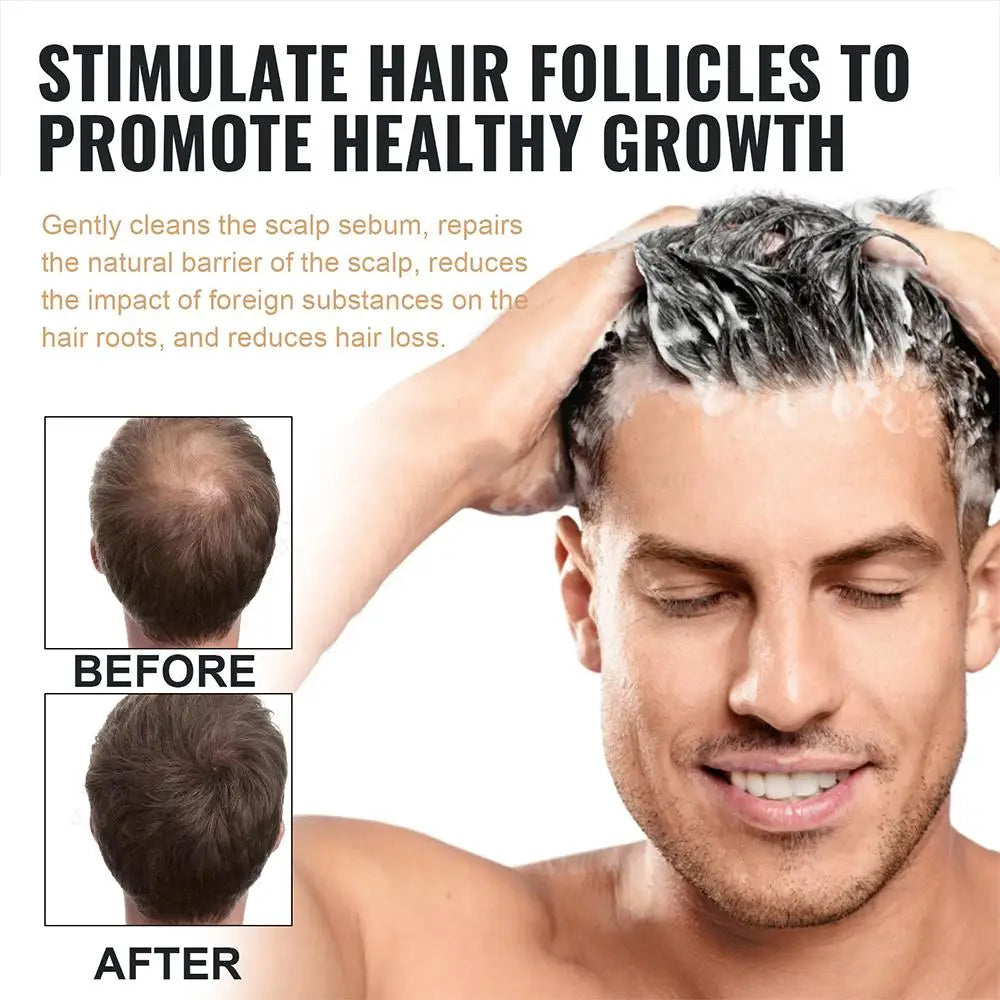Thickening Root Activator Shampoo