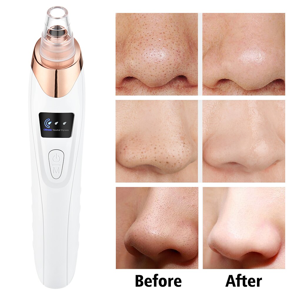 Electric Vacuum Blackhead Remover Suction