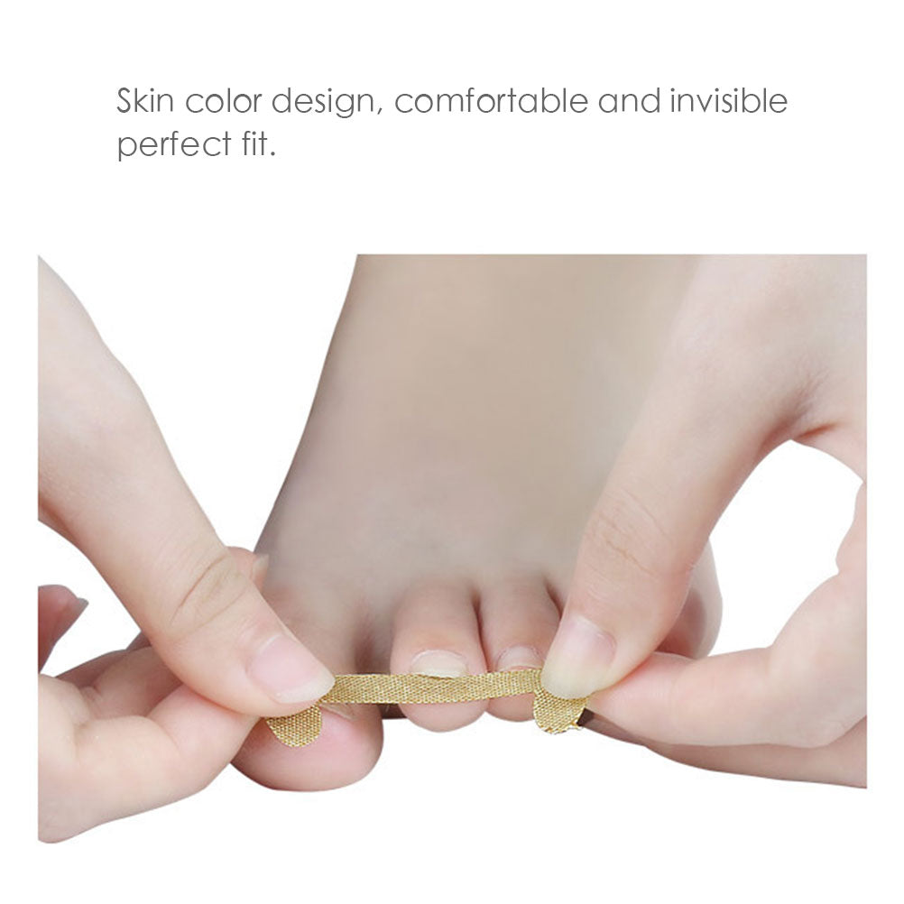 20pcs Professional Embedded Toe Nail Corrector
