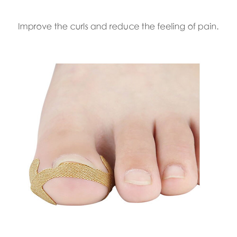 20pcs Professional Embedded Toe Nail Corrector