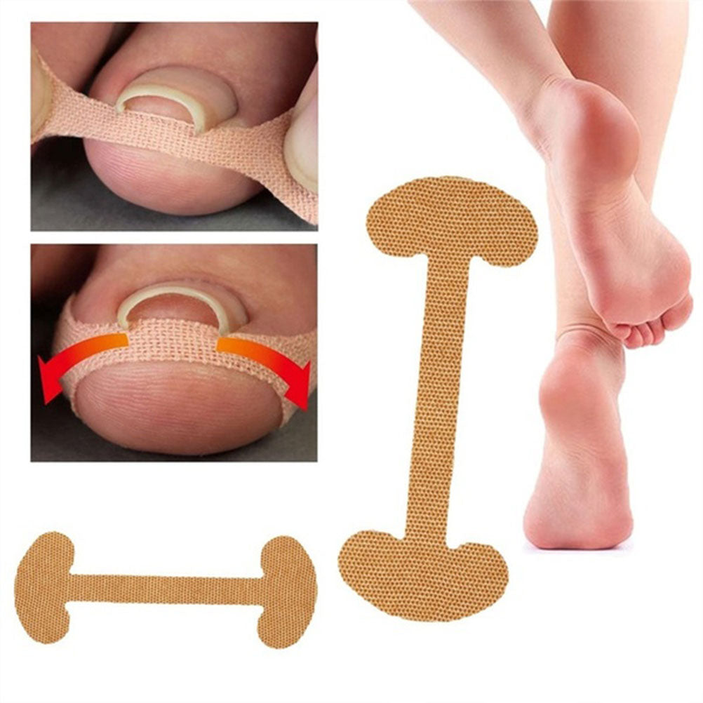20pcs Professional Embedded Toe Nail Corrector