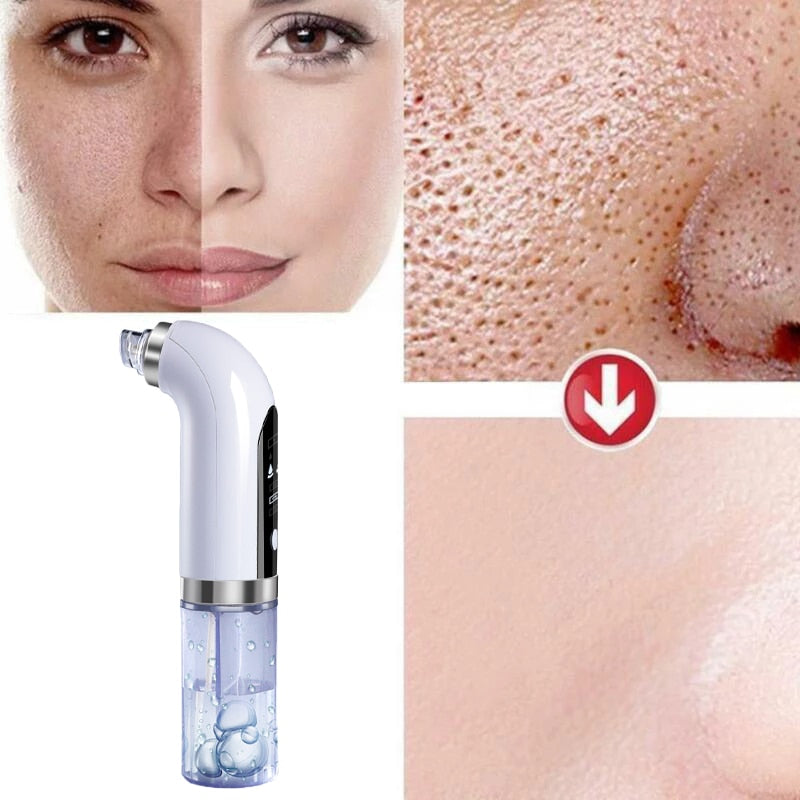 Blackhead Remover Pore Vacuum Cleaner