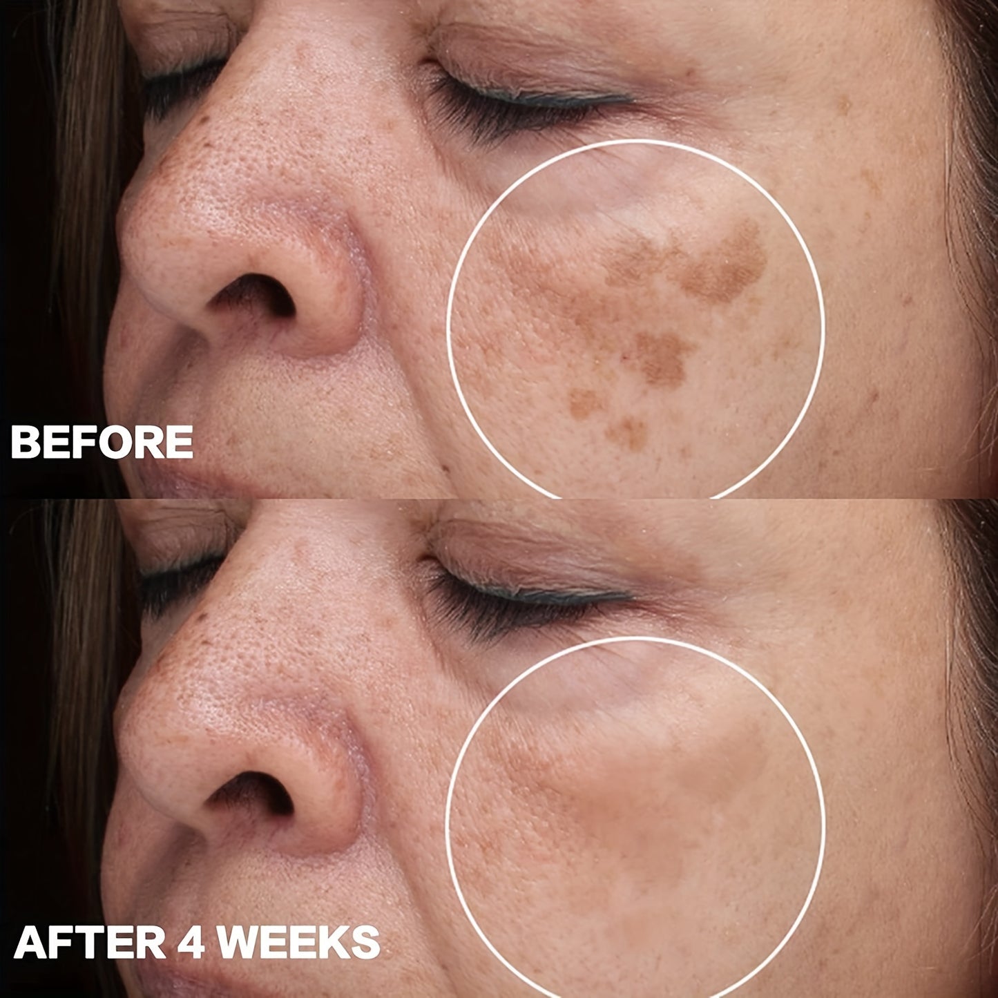 2pcs Hyperpigmentation Facial Cream
