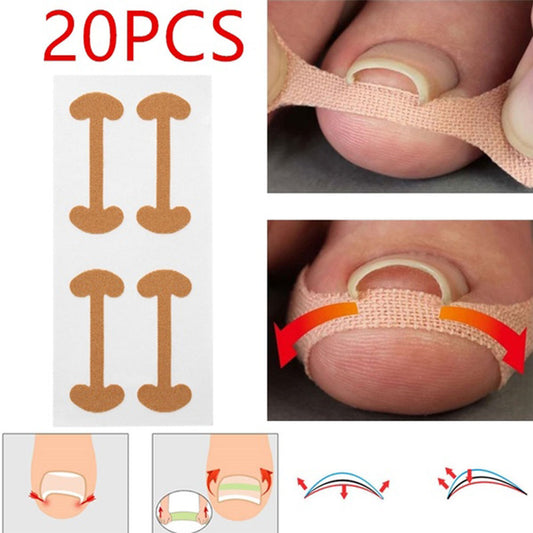 |14:200006151#20 pcs