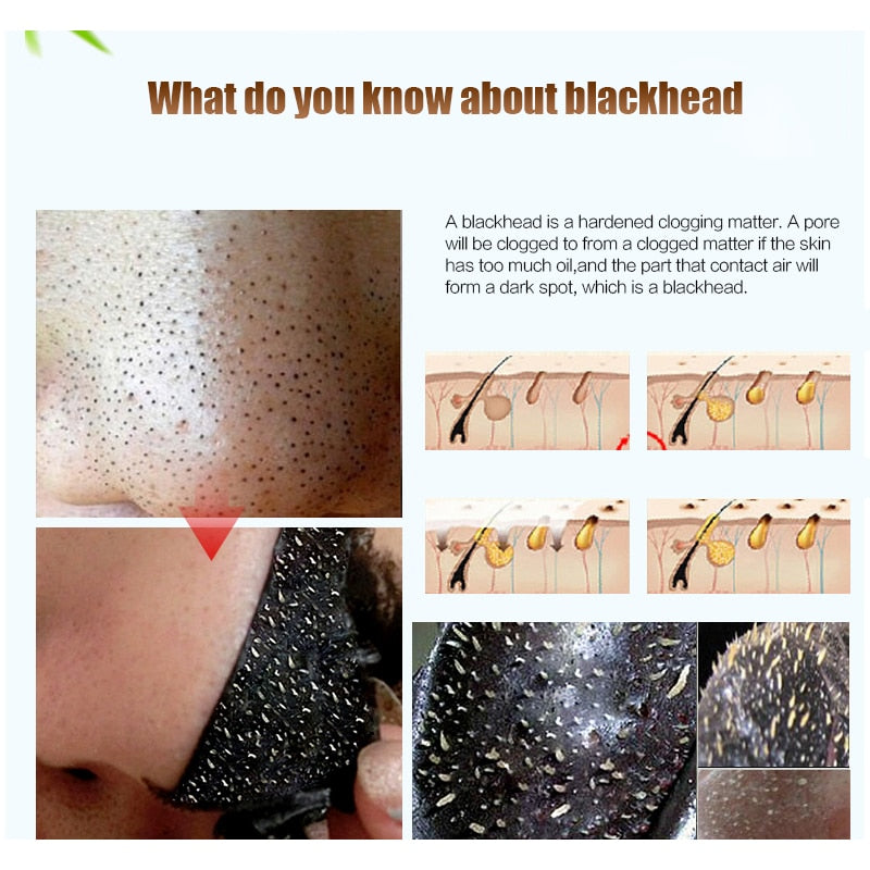 EFERO Black Head Remover Mask 3/5/6/10/13packs