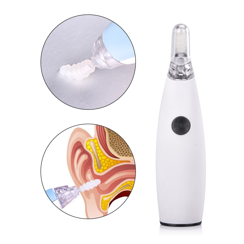 Ear Wax Cleaner Painless Powered Safety Cordles Electric Cleaning Tool